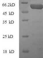 Human Kynurenine 3-monooxygenase (KMO) Recombinant Protein, N-His-SUMO - BioCrest Sci
