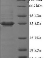 Human Glutaminyl-peptide cyclotransferase-like protein (QPCTL), partial Recombinant Protein - BioCrest Sci