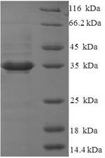 Human Glutaminyl-peptide cyclotransferase-like protein (QPCTL), partial Recombinant Protein, Homo sapiens (Human), E.coli, N-terminal 6xHis-SUMO-tagged, 35.5 kDa, purity >≥ 90% as determined by SDS-PAGE.