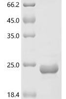 Sitophilus zeamais Odorant binding protein 1 (OBP1), partial Recombinant Protein - BioCrest Sci