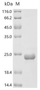 Sitophilus zeamais Odorant binding protein 1 (OBP1), partial Recombinant Protein, Sitophilus zeamais (Maize weevil), E.coli, C-terminal 6xHis-tagged, 19.9 kDa, purity >≥ 90% as determined by SDS-PAGE.