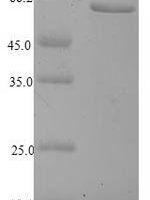 Human Nuclear receptor subfamily 2 group F member 6 (NR2F6) Recombinant Protein, N-His-SUMO - BioCrest Sci