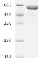 Human Receptor-type tyrosine-protein phosphatase-like N (PTPRN), partial Recombinant Protein, C-His-Myc - BioCrest Sci