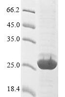 Crassostrea gigas A-kinase anchor protein 7 isoform X2 Recombinant Protein, C-Myc - BioCrest Sci