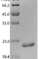Mouse Osteocalcin (Bglap) Recombinant Protein, N-His-KSI - BioCrest Sci