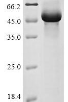 Human Transmembrane protease serine 11A (TMPRSS11A), partial Recombinant Protein, N-His - BioCrest Sci