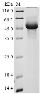 Human Transmembrane protease serine 11A (TMPRSS11A), partial Recombinant Protein, N-His, Homo sapiens (Human), E.coli, N-terminal 6xHis-tagged, 49.2 kDa, purity >≥ 85% as determined by SDS-PAGE.