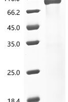 Human Granulocyte-macrophage colony-stimulating factor receptor subunit alpha(CSF2RA), partial Recombinant Protein - BioCrest Sci