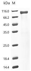Human Granulocyte-macrophage colony-stimulating factor receptor subunit alpha(CSF2RA), partial Recombinant Protein, Homo sapiens (Human), Mammalian cell, C-terminal hFc1-tagged, 63.4 kDa, purity >≥ 85% as determined by SDS-PAGE.