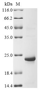 Xenopus tropicalis 60S ribosomal protein L36 (rpl36) Recombinant Protein, Xenopus tropicalis(Western clawed frog)(Silurana tropicalis), E.coli, N-terminal 10xHis-tagged and C-terminal Myc-tagged, 19.8 kDa, purity >≥ 85% as determined by SDS-PAGE.