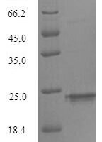 Mouse Triggering receptor expressed on myeloid cells 2 (Trem2), partial Recombinant Protein, N-His-Myc - BioCrest Sci