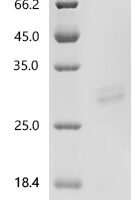 Human Peroxiredoxin-6 (PRDX6) Recombinant Protein, N-His - BioCrest Sci