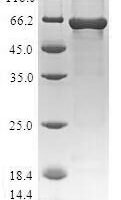 Human RISC-loading complex subunit TARBP2 (TARBP2) Recombinant Protein, N-GST - BioCrest Sci