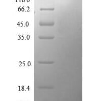 Mouse C-C motif chemokine 12 (Ccl12) Recombinant Protein - BioCrest Sci