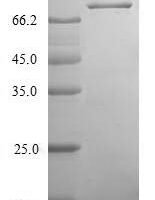 Human Coiled-coil domain-containing protein 41 (CCDC41) Recombinant Protein - BioCrest Sci