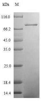 Human Coiled-coil domain-containing protein 41 (CCDC41) Recombinant Protein, Homo sapiens (Human), E.coli, N-terminal 6xHis-SUMO-tagged, 83.4 kDa, purity >≥ 90% as determined by SDS-PAGE.