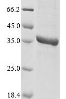 Human herpesvirus 6A Triplex capsid protein 1 (TRX1) Recombinant Protein - BioCrest Sci