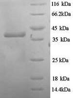 Escherichia coli Hygromycin-B 4-O-kinase (hph) Recombinant Protein - BioCrest Sci