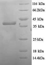 Escherichia coli Hygromycin-B 4-O-kinase (hph) Recombinant Protein, Escherichia coli, Yeast, N-terminal 6xHis-tagged, 40.0 kDa, purity >≥ 90% as determined by SDS-PAGE.