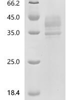 Human Tumor necrosis factor receptor superfamily member 13C (TNFRSF13C)(L28F), partial Recombinant Protein - BioCrest Sci