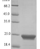 Human Peptidyl-prolyl cis-trans isomerase A (PPIA) Recombinant Protein, N-10His/C-Myc - BioCrest Sci