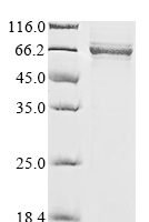 Human B-cell lymphoma 6 protein (BCL6), partial Recombinant Protein - BioCrest Sci