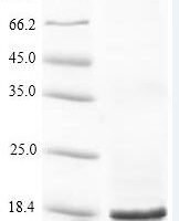 Anaplasma phagocytophilum 50S ribosomal protein L22 (rplV) Recombinant Protein - BioCrest Sci