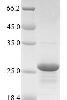 Mouse Beta-defensin 33 (Defb33) Recombinant Protein - BioCrest Sci