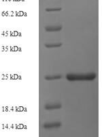 Mycobacterium tuberculosis ESAT-6-like protein EsxH (esxH), partial Recombinant Protein - BioCrest Sci