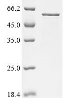 Human Z-DNA-binding protein 1 (ZBP1) Recombinant Protein, N-10His/C-Myc - BioCrest Sci