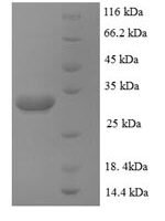 Human Zinc transporter ZIP1 (SLC39A1), partial Recombinant Protein - BioCrest Sci