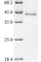 Human Dipeptidase 1 (DPEP1) Recombinant Protein - BioCrest Sci