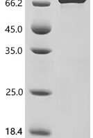 Human Neutrophil elastase (ELANE), partial Recombinant Protein, N-HSA/C-10His - BioCrest Sci