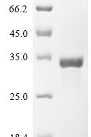 Human CCR4-NOT transcription complex subunit 7 (CNOT7) Recombinant Protein, N-His - BioCrest Sci
