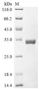 Human CCR4-NOT transcription complex subunit 7 (CNOT7) Recombinant Protein, N-His, Homo sapiens (Human), E.coli, N-terminal 6xHis-tagged, 36.8 kDa, purity >≥ 85% as determined by SDS-PAGE.