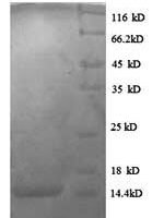 Human C-C motif chemokine 24 (CCL24) Recombinant Protein, N-His - BioCrest Sci