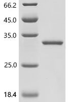 C-terminal GST-tagged Recombinant Protein - BioCrest Sci