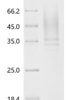 Human Interleukin-4 receptor subunit alpha (IL4R), partial Recombinant Protein, N-His - BioCrest Sci