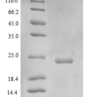 Human Extracellular superoxide dismutase [Cu-Zn] (SOD3) Recombinant Protein, Tag-Free - BioCrest Sci