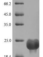 Human Dedicator of cytokinesis protein 8 (DOCK8), partial Recombinant Protein, N-10His - BioCrest Sci