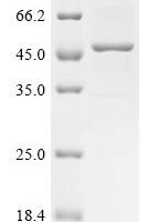 Eucalyptus gunnii Caffeic acid 3-O-methyltransferase (OMT) Recombinant Protein - BioCrest Sci
