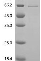 Rat Phosphatidylinositol 4,5-bisphosphate 3-kinase catalytic subunit alpha isoform (Pik3ca)(K802A), partial Recombinant Protein - BioCrest Sci