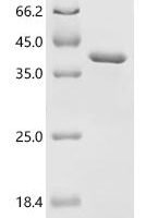 Rat Phosducin (Pdc) Recombinant Protein - BioCrest Sci