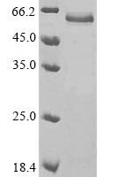 Human Tissue-type plasminogen activator (PLAT) (Y471H) Recombinant Protein - BioCrest Sci