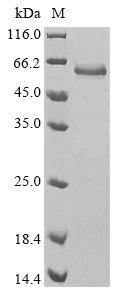 Human Tissue-type plasminogen activator (PLAT) (Y471H) Recombinant Protein, Homo sapiens (Human), Baculovirus, N-terminal 10xHis-tagged and C-terminal Myc-tagged, 62.9 kDa, purity >≥ 85% as determined by SDS-PAGE.