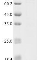 Human Gasdermin-D (GSDMD),Biotinylated Recombinant Protein - BioCrest Sci