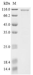 Human Gasdermin-D (GSDMD),Biotinylated Recombinant Protein, Homo sapiens (Human), E.coli, N-terminal MBP-tagged and C-terminal 6xHis-Avi-tagged, 100.6 kDa, purity >≥ 85% as determined by SDS-PAGE.