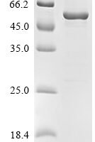 Human Cyclin-G-associated kinase (GAK), partial, Biotinylated Recombinant Protein - BioCrest Sci