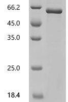Caenorhabditis elegans Transcription factor elt-2 (elt-2) Recombinant Protein - BioCrest Sci