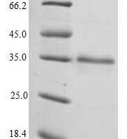 Human Elongation factor 1-delta (EEF1D) Recombinant Protein - BioCrest Sci